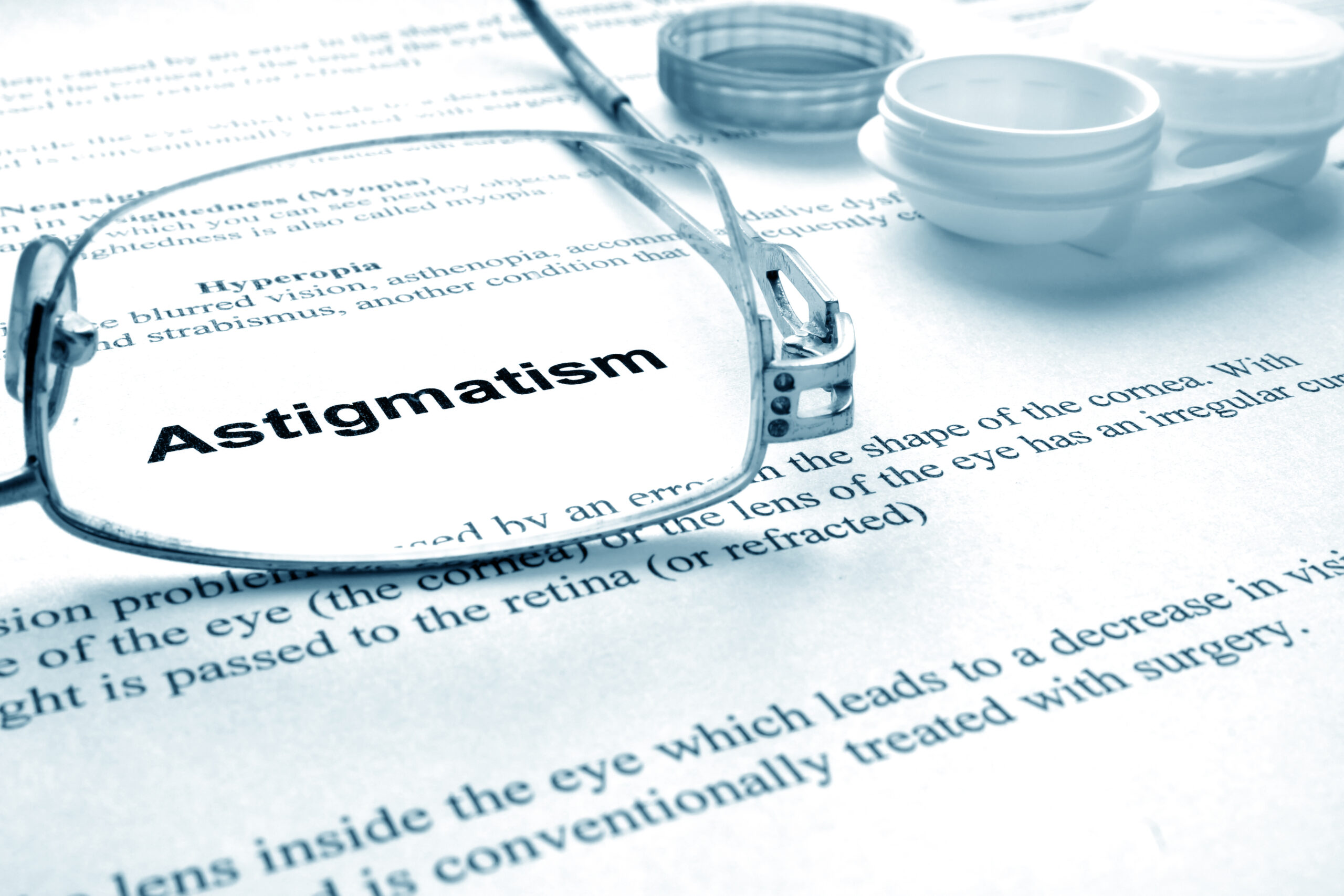Astigmatism and Contact Lenses