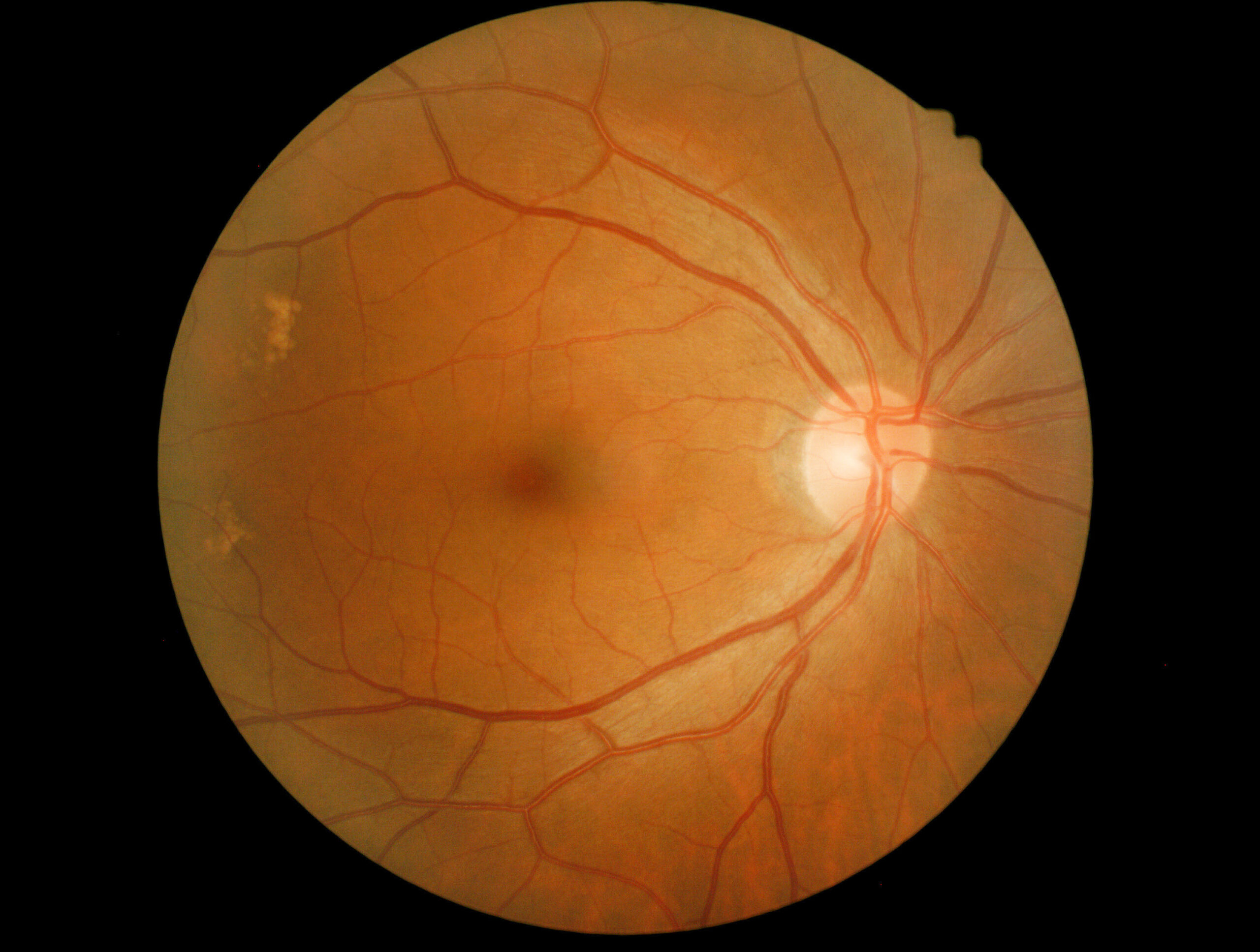 Anatomical Structures and Soft Contact Lenses