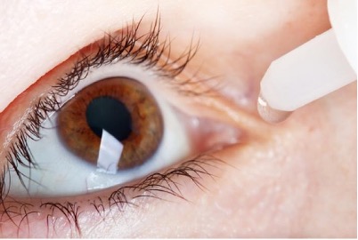 Eyes on Dryness: Identifying, Understanding, and Managing Dry Eye Syndrome