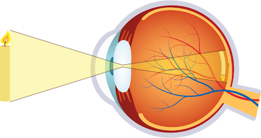 Contact Lenses and the Anatomy of the Visual Pathway