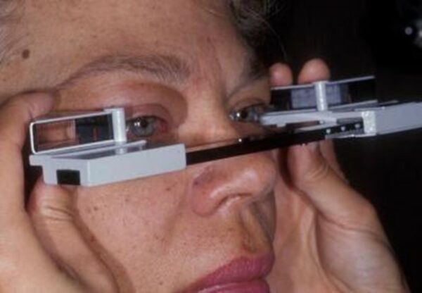 Innovation in The Treatment of Thyroid Eye Disease